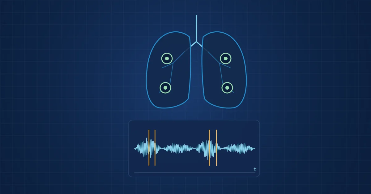 Illustration: line drawing of lungs with four chest sensors and a breath-sound recording containing crackles
